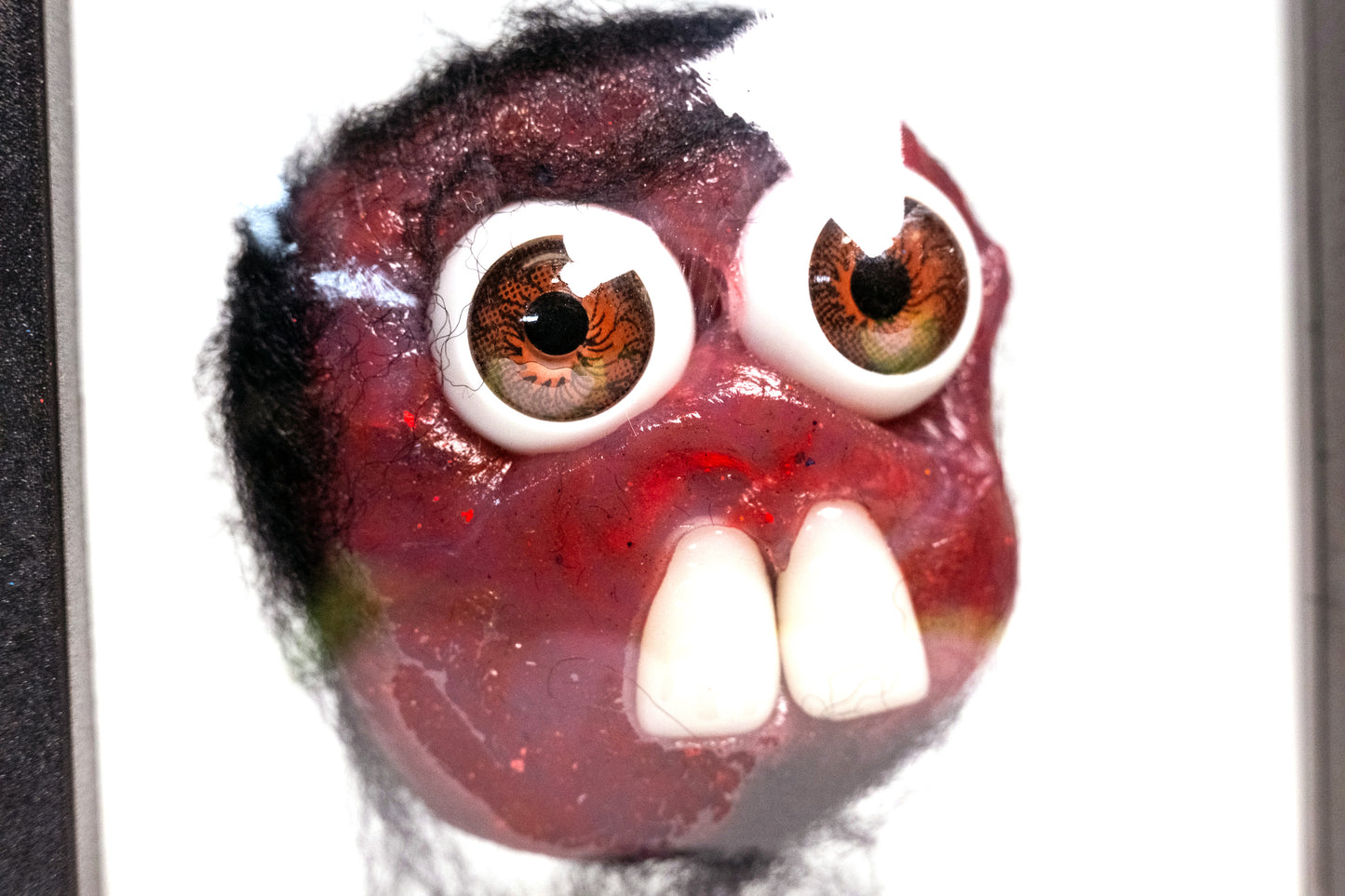 Teratoma Desadorable